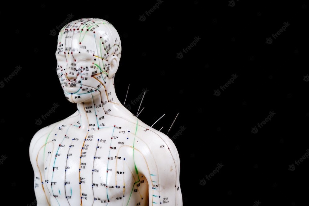 Ligger forklaringen på akupunktur- effekten  i hvordan hjernen samarbeider med kroppen?